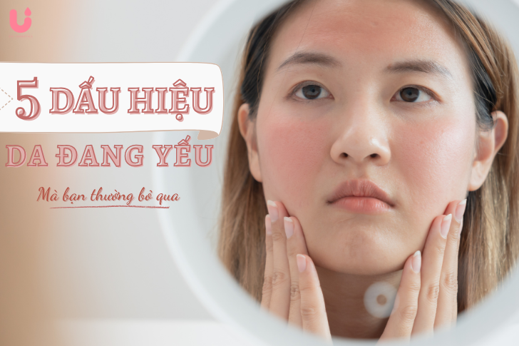 5 dấu hiệu da đang yếu mà bạn thường bỏ qua